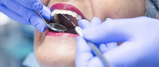 Best Emergency Treatment for Dental Infections or Abscesses in Prien, LA